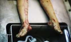 İsrail'in Gazze'de zorla boşalttığı hastanede kalan bebeklerin çürümüş cesetleri bulundu
