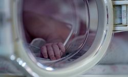 Dünyaya 430 gram gelen prematüre bebeğe kalp ameliyatı