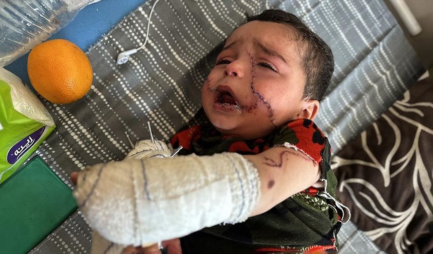 İsrail saldırısında ağır yaralanan Filistinli bebek için Gazze dışında tedavi imkanı aranıyor