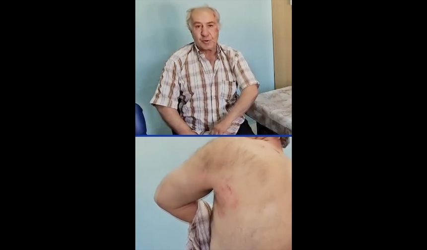 Burdur'da sahipsiz köpeklerin saldırdığı kişi yaralandı